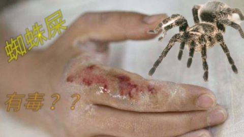 蜘蛛尿在皮肤上起泡图图片