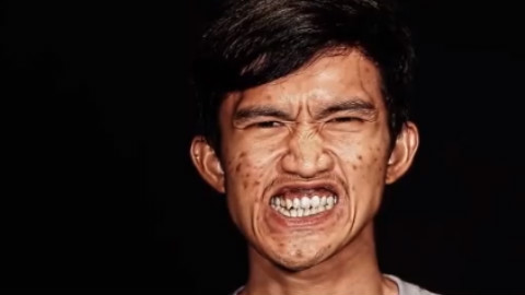 丑小伙赴韩国整容变美男