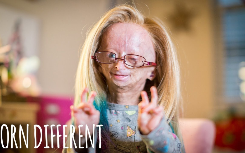 意大利一位60岁的老奶奶一边接受脑部手术一边在手术台上腌制了90颗