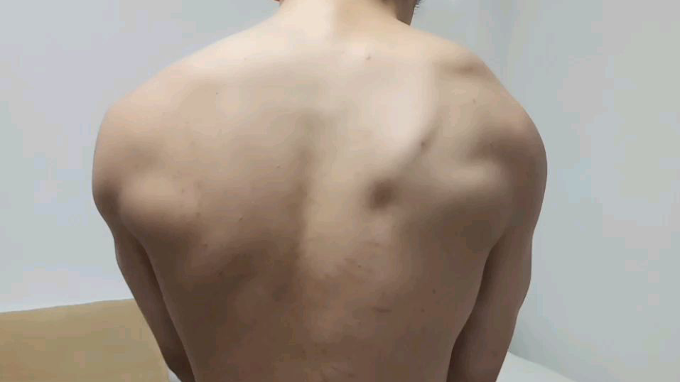 初中生的后背(这个水平给几分?)