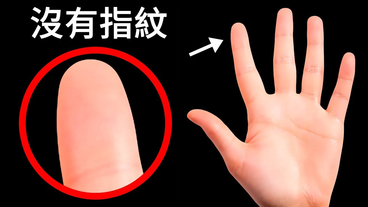 如果所有人都没有了指纹,那么会发生什么事情?