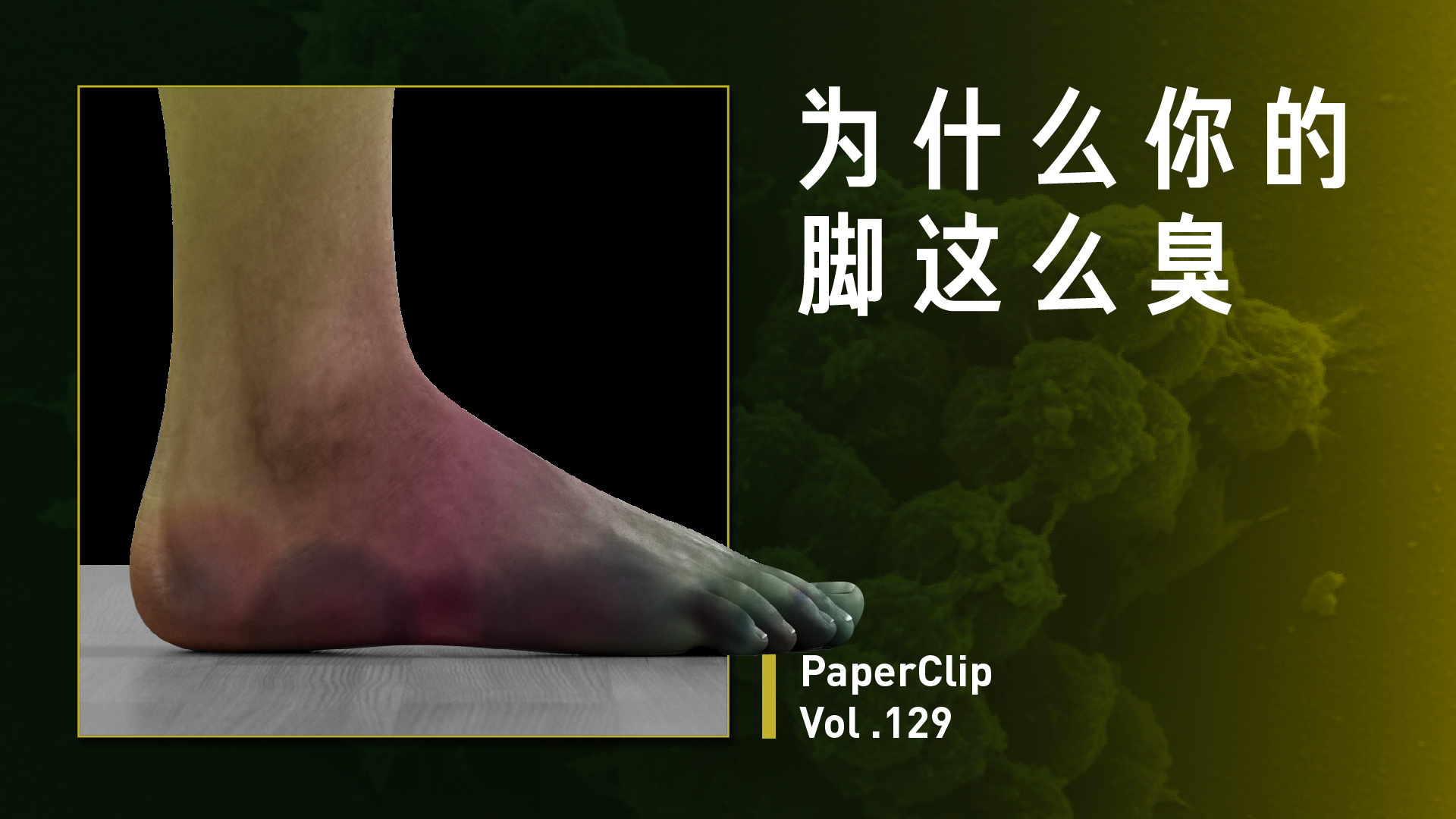 Vol.129 为什么你的脚这么臭