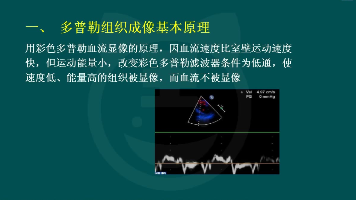 2020超声主治课程-组织多普勒成像