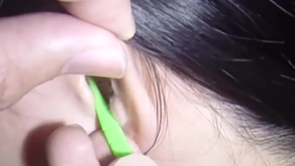 十大掏耳视频合集...