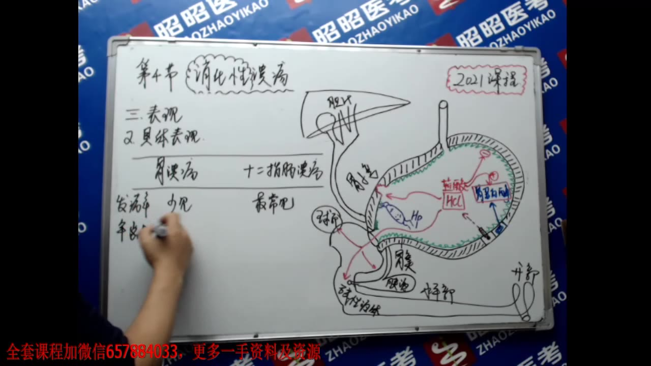 2021昭昭医考消化系统最新课-消化性溃疡视频 执业医师/助理课程