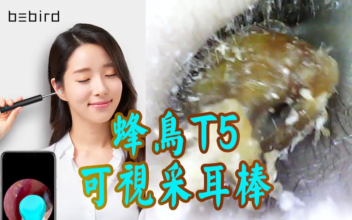 【布瞎BB】蜂鸟T5可视采耳棒